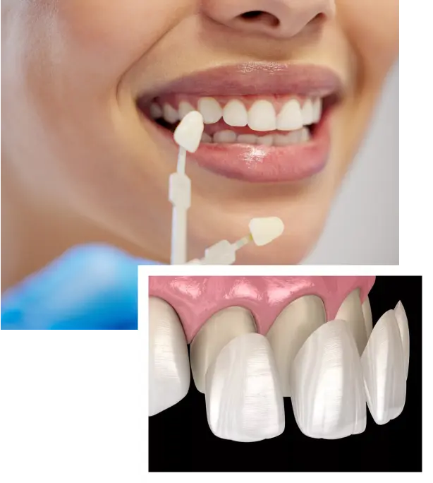 Image Frame2